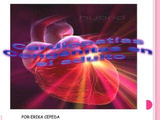Cardiopatías Congénitas en  el adulto POR:ERIKA CEPEDA 