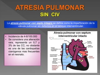 Cardiopatia cianogena. Tetralogia de fallot y Atresia tricuspidea.pptx