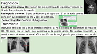 Diagnostico
Electrocardiograma: Desviación del eje eléctrico a la izquierda y signos de
hipertrofia ventricular izquierda.
Radiografía de tórax: Signo de Roesler y el signo del “3” en la aorta que es la
aorta con sus dilataciones pre y post estenóticas.
Ecocardiografía: Confirma el diagnóstico
Tratamiento
Intervenir antes de los 5 años preferentemente. Si no se repara la esperanza de vida es
40- 50 años por el daño que ocasiona a la propia aorta. Se realiza resección y
anastomosis término- terminal. Otra opción es la angioplastia percutánea, con o sin
stent
 