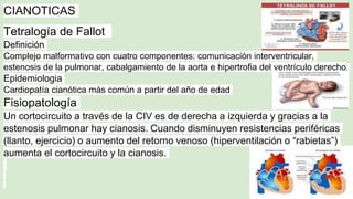 CIANOTICAS
Tetralogía de Fallot
Definición
Complejo malformativo con cuatro componentes: comunicación interventricular,
estenosis de la pulmonar, cabalgamiento de la aorta e hipertrofia del ventrículo derecho.
Epidemiologia
Cardiopatía cianótica más común a partir del año de edad
Fisiopatología
Un cortocircuito a través de la CIV es de derecha a izquierda y gracias a la
estenosis pulmonar hay cianosis. Cuando disminuyen resistencias periféricas
(llanto, ejercicio) o aumento del retorno venoso (hiperventilación o “rabietas”)
aumenta el cortocircuito y la cianosis.
 