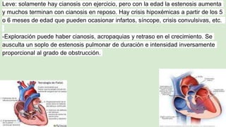 Leve: solamente hay cianosis con ejercicio, pero con la edad la estenosis aumenta
y muchos terminan con cianosis en reposo. Hay crisis hipoxémicas a partir de los 5
o 6 meses de edad que pueden ocasionar infartos, síncope, crisis convulsivas, etc.
-Exploración puede haber cianosis, acropaquias y retraso en el crecimiento. Se
ausculta un soplo de estenosis pulmonar de duración e intensidad inversamente
proporcional al grado de obstrucción.
 