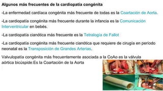 Algunos más frecuentes de la cardiopatía congénita
-La enfermedad cardíaca congénita más frecuente de todas es la Coartación de Aorta.
-La cardiopatía congénita más frecuente durante la infancia es la Comunicación
Interventricular en bebés.
-La cardiopatía cianótica más frecuente es la Tetralogía de Fallot
-La cardiopatía congénita más frecuente cianótica que requiere de cirugía en período
neonatal es la Transposición de Grandes Arterias.
Valvulopatía congénita más frecuentemente asociada a la CoAo es la válvula
aórtica bicúspide:Es la Coartación de la Aorta
 