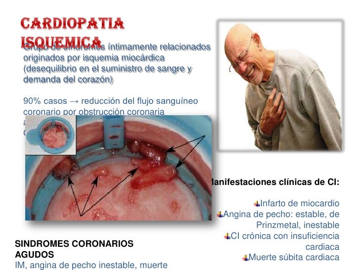 37 semanas duele fuerte la espalda