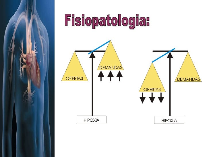 A Fisiopatologia Da Cardiopatia Isquêmica Envolve Especificamente Dois Processos