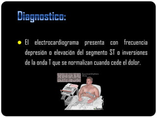  El electrocardiograma presenta con frecuencia
  depresión o elevación del segmento ST o inversiones
  de la onda T que se normalizan cuando cede el dolor.
 