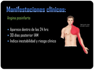 Angina posinfarto

 Aparece dentro de las 24 hrs
 30 días posterior IAM
 Indica inestabilidad y riesgo clínico
 