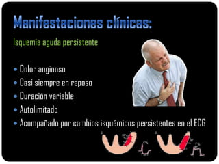 Isquemia aguda persistente

 Dolor anginoso
 Casi siempre en reposo
 Duración variable
 Autolimitado
 Acompañado por cambios isquémicos persistentes en el ECG
 