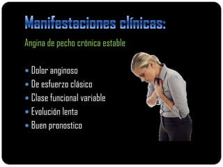 Angina de pecho crónica estable

 Dolor anginoso
 De esfuerzo clásico
 Clase funcional variable
 Evolución lenta
 Buen pronostico
 