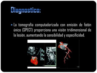  La tomografía computadorizada con emisión de fotón
 único (SPECT) proporciona una visión tridimensional de
 la lesión, aumentando la sensibilidad y especificidad.
 