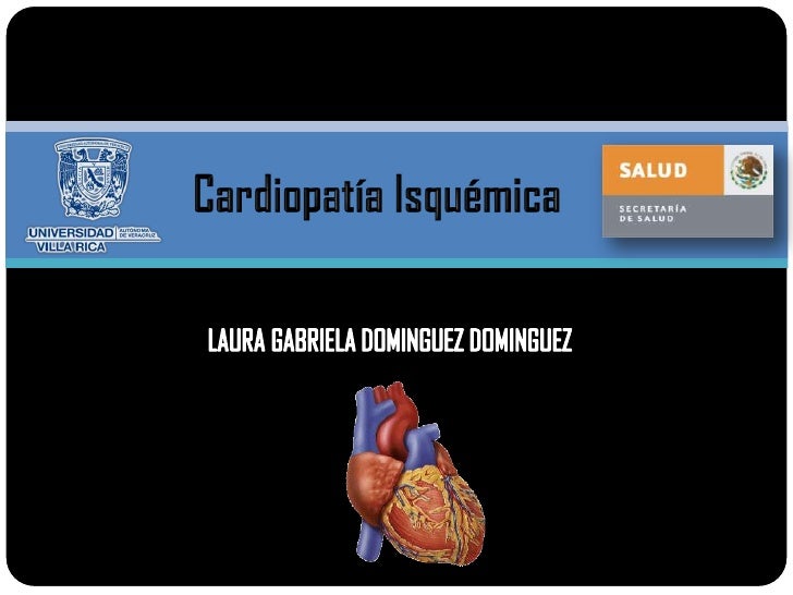 Cardiopatia isquemica