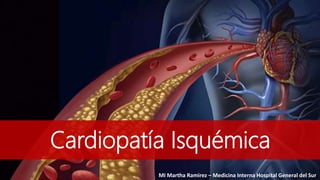 Cardiopatía Isquémica
MI Martha Ramirez – Medicina Interna Hospital General del Sur
 