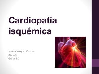 Cardiopatía
isquémica
Jessica Vázquez Orozco
253936
Grupo 6.2
 
