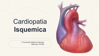 Cardiopatia
Isquemica
V.Fernanda Calderón Gándara
Matricula 154188
 