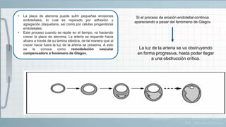 • La placa de ateroma puede sufrir pequeñas erosiones
endoteliales, lo cual es reparado por adhesión y
agregación plaquetaria, así como por células progenitoras
endoteliales.
• Este proceso cuando se repite en el tiempo, va haciendo
crecer la placa de ateroma. La arteria se expande hacia
afuera a través de su lámina elástica, de tal manera que al
crecer hacia fuera la luz de la arteria se preserva. A esto
se le conoce como remodelación vascular
compensadora o fenómeno de Glagov.
Si el proceso de erosión endotelial continúa
apareciendo a pesar del fenómeno de Glagov
La luz de la arteria se va obstruyendo
en forma progresiva, hasta poder llegar
a una obstrucción crítica.
Guadalajara, J. (2012). Cardiología. México,
D.F.: Méndez Editores.
 