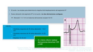 ○ El punto J se emplea para determinar la magnitud del desplazamiento del segmento ST
○ Nueva elevación del segmento ST en el punto J en dos derivaciones contiguas:
● Elevación > 0.1 mV en todas las derivaciones excepto V2-V3
 V2-V3:
 Hombres mayores de 40 años elevación > 0.2
mV
 Hombres menores de 40 años elevación >0.25
mV
 Mujeres >0.15 mV
 En infarto inferior realizar
derivaciones derechas V3R
y V4R
Thygesen Kristian, Third Universal Definition of Myocardial Infraction, Journal of American College of Cardiology, European
Society of Cardiology, American College of Cardiology Foundation, American Heart Association, Inc., and the World Heart
Federation, volumen 60, No. 16, 2012
 