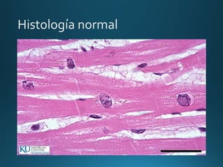 Histología normal
 