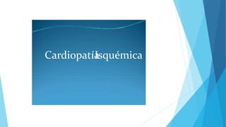 Cardiopatía
Isquémica
 