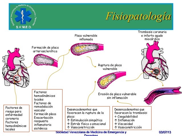 Cardiopatia Isquemica Y Factores De Riesgo - 