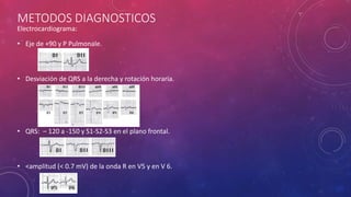 METODOS DIAGNOSTICOS
Electrocardiograma:
• Eje de +90 y P Pulmonale.
• Desviación de QRS a la derecha y rotación horaria.
• QRS: – 120 a -150 y S1-S2-S3 en el plano frontal.
• <amplitud (< 0.7 mV) de la onda R en V5 y en V 6.
 