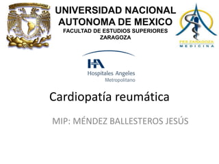 Cardiopatía reumática
MIP: MÉNDEZ BALLESTEROS JESÚS
UNIVERSIDAD NACIONAL
AUTONOMA DE MEXICO
FACULTAD DE ESTUDIOS SUPERIORES
ZARAGOZA
 