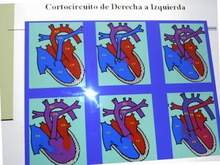 Cardiopatias