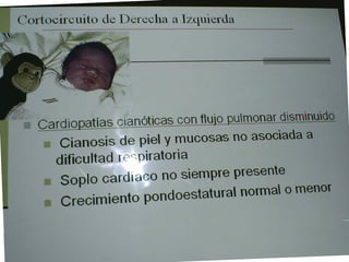 Cardiopatias