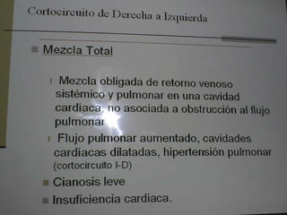 Cardiopatias