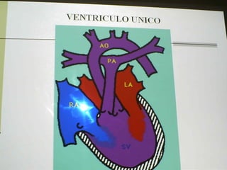Cardiopatias