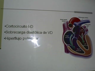Cardiopatias