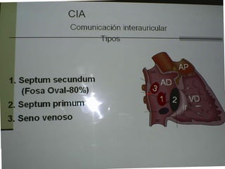 Cardiopatias