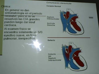 Cardiopatias