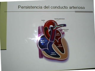 Cardiopatias