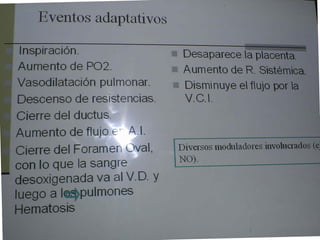 Cardiopatias