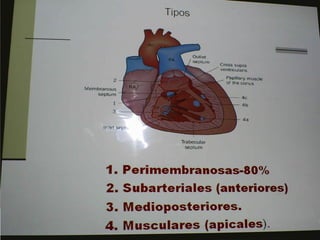 Cardiopatias