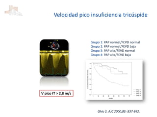 Grupo 1: PAP normal/FEVD normal
Grupo 2: PAP normal/FEVD baja
Grupo 3: PAP alta/FEVD normal
Grupo 4: PAP alta/FEVD baja
Ghio S. AJC 2000;85: 837-842.
Velocidad pico insuficiencia tricúspide
V pico IT > 2,8 m/s
 