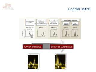 Función diastólica Síntomas congestivos
Doppler mitral
 