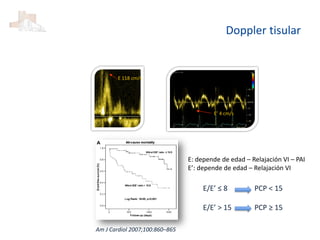 E 118 cm/s
E’ 4 cm/s
E/E’ ≤ 8
E/E’ > 15
PCP < 15
PCP ≥ 15
Am J Cardiol 2007;100:860–865
E: depende de edad – Relajación VI – PAI
E’: depende de edad – Relajación VI
Doppler tisular
 