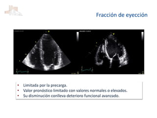 Fracción de eyección
• Limitada por la precarga.
• Valor pronóstico limitado con valores normales o elevados.
• Su disminución conlleva deterioro funcional avanzado.
 