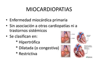 MIOCARDIOPATIAS
• Enfermedad miocárdica primaria
• Sin asociación a otras cardiopatías ni a
trastornos sistémicos
• Se clasifican en:
* Hipertrófica
* Dilatada (o congestiva)
* Restrictiva
 