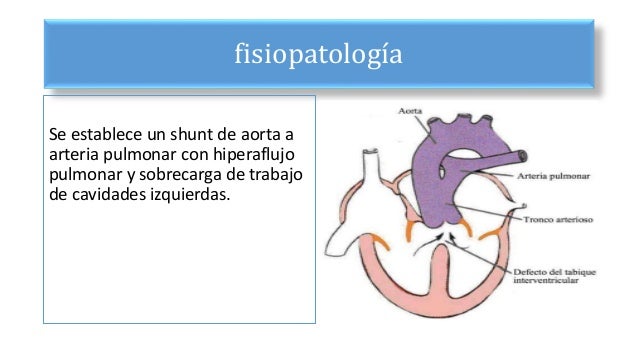 Cardiopatia Congenita Cianogena Mas Frecuente