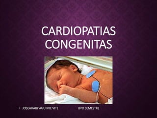 CARDIOPATIAS
CONGENITAS
• JOSEAHARY AGUIRRE VITE 8VO SEMESTRE
 