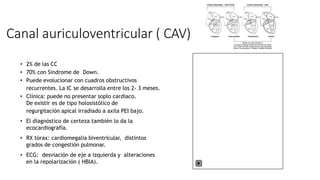 Canal auriculoventricular ( CAV)
• 2% de las CC
• 70% con Sindrome de Down.
• Puede evolucionar con cuadros obstructivos
recurrentes. La IC se desarrolla entre los 2- 3 meses.
• Clínica: puede no presentar soplo cardiaco.
De existir es de tipo holosistólico de
regurgitación apical irradiado a axila PEI bajo.
• El diagnóstico de certeza también lo da la
ecocardiografía.
• RX tórax: cardiomegalia biventricular, distintos
grados de congestión pulmonar.
• ECG: desviación de eje a izquierda y alteraciones
en la repolarización ( HBIA).
 