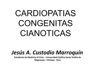 CARDIOPATIAS CONGENITAS CIANOTICAS Jesús A. Custodio Marroquín Estudiante de Medicina VI Ciclo – Universidad Católica Santo Toribio de Mogrovejo – Chiclayo - Perú 