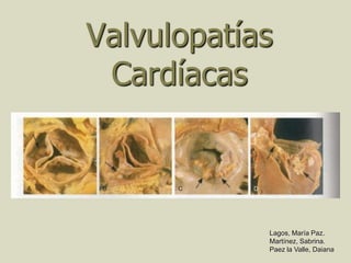 Valvulopatías
 Cardíacas



            Lagos, María Paz.
            Martínez, Sabrina.
            Paez la Valle, Daiana
 