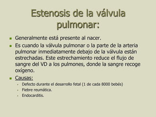 Estenosis de la válvula
                 pulmonar:
   Generalmente está presente al nacer.
   Es cuando la válvula pulmonar o la parte de la arteria
    pulmonar inmediatamente debajo de la válvula están
    estrechadas. Este estrechamiento reduce el flujo de
    sangre del VD a los pulmones, donde la sangre recoge
    oxígeno.
   Causas:
       Defecto durante el desarrollo fetal (1 de cada 8000 bebés)
       Fiebre reumática.
       Endocarditis.
 