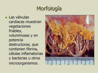 Morfología
   Las válvulas
    cardiacas muestran
    vegetaciones
    friables,
    voluminosas y en
    potencia
    destructoras, que
    contienen fibrina,
    células inflamatorias
    y bacterias u otros
    microorganismos.
 