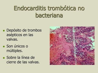 Endocarditis trombótica no
               bacteriana

   Depósito de trombos
    asépticos en las
    valvas.
   Son únicos o
    múltiples.
   Sobre la línea de
    cierre de las valvas.
 