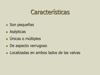 Características
   Son pequeñas
   Asépticas
   Únicas o múltiples
   De aspecto verrugoso
   Localizadas en ambos lados de las valvas
 