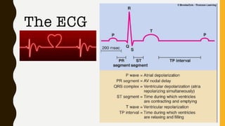 The ECG
 