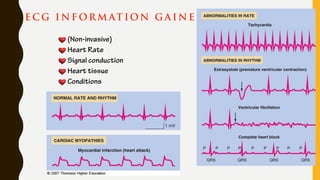 E C G I N F OR M AT ION G A I N E D
(Non-invasive)
Heart Rate
Signal conduction
Heart tissue
Conditions
 